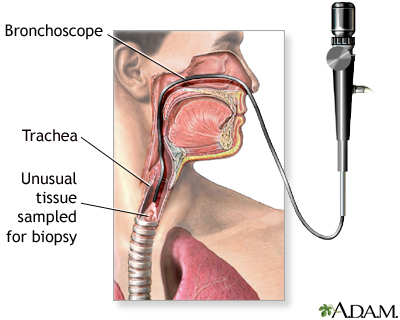 Upper airway test