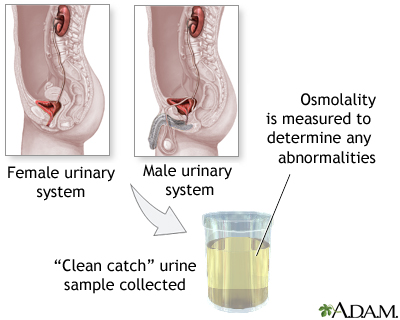 Osmolality test