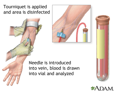 Blood test