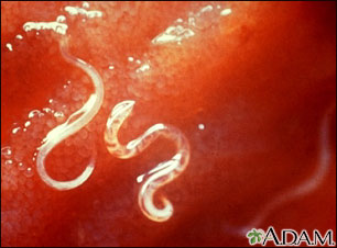 Hookworm - Ancyclostoma caninum