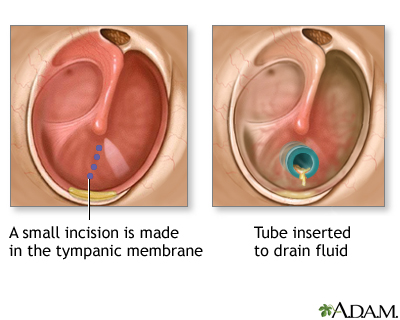 Procedure