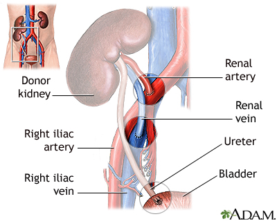 Procedure