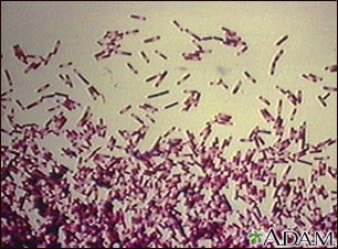 Clostridium difficile organism