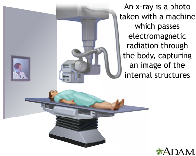 X-ray