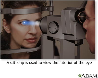 Slit-lamp exam