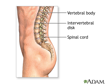 Normal anatomy