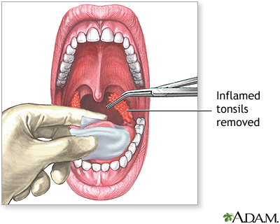 Procedure