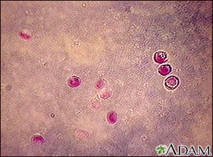 Cryptosporidium, organism