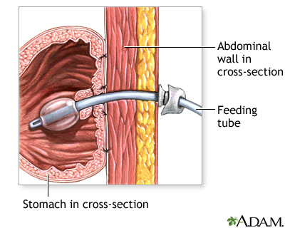 Procedure, part 1