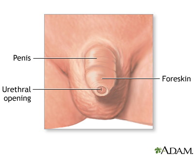 Normal anatomy