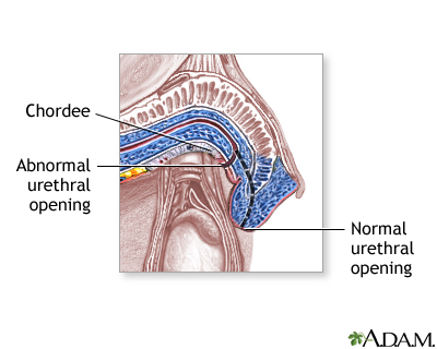 Procedure