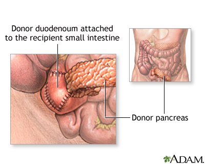 Procedure, part 1