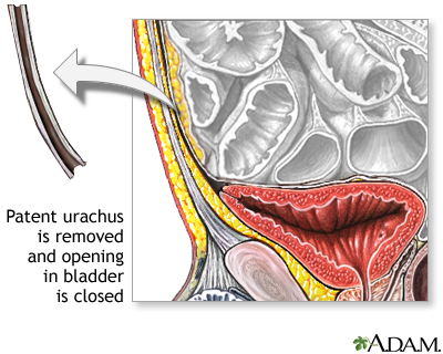 Procedure