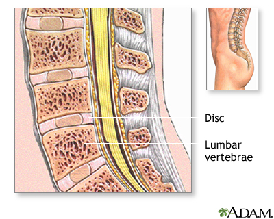 Normal anatomy