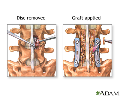 Procedure, part 2