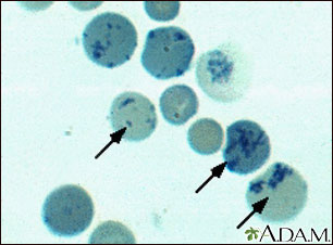 Reticulocytes