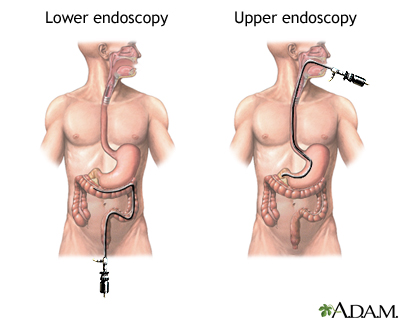 Procedure, part 1