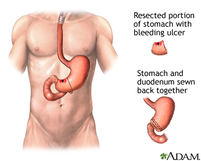 Procedure, part 3