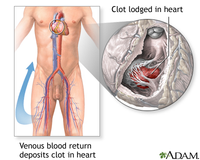 Procedure, part 1