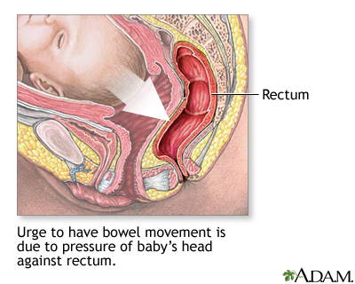 Emergency Childbirth