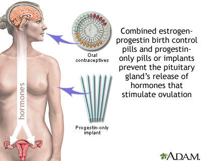 Hormone-based contraceptives