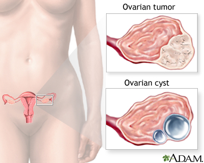 Ovarian growth worries