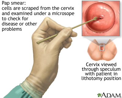 Pap smear