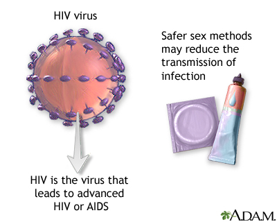 HIV