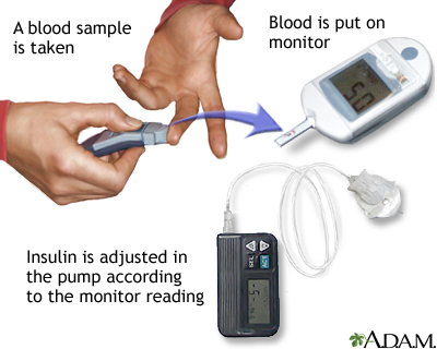 Insulin test