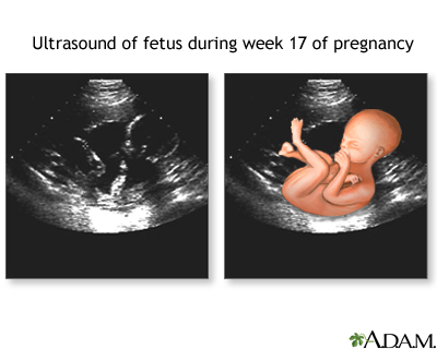 17 week ultrasound