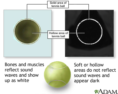 Ultrasound comparison