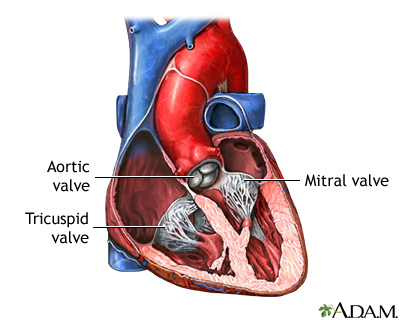 Normal anatomy