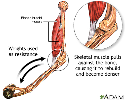 Bone-building exercise