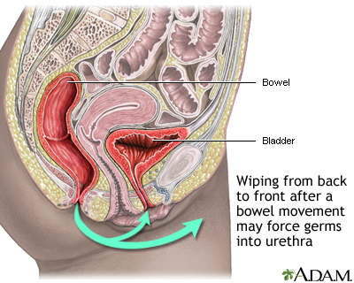 Prevention of cystitis