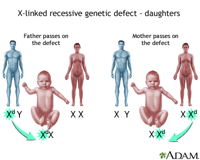 X-linked recessive genetic defects - how girls are affected