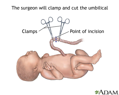 Procedure, part 6