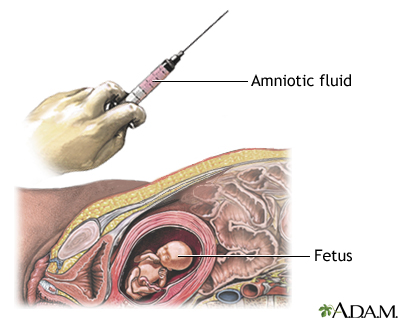 Procedure, part 2