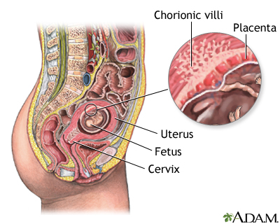 Normal anatomy