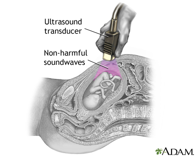 Procedure, part 2