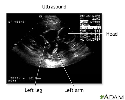 Procedure, part 3