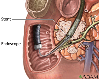 Procedure