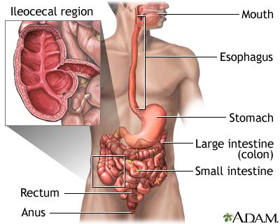 Crohn's disease - affected areas