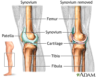 Knee joint