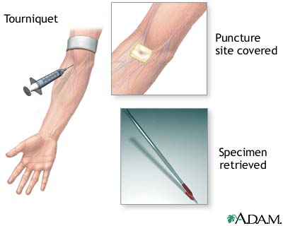 Procedure, part 2