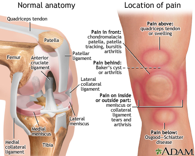 Knee pain