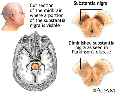 Substantia nigra