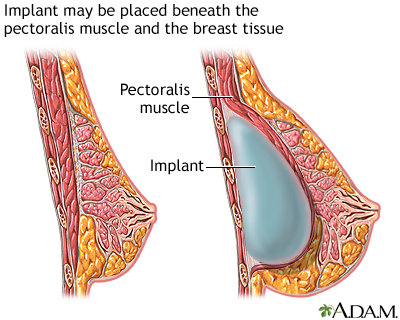 Procedure