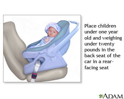 Rear-facing car seat