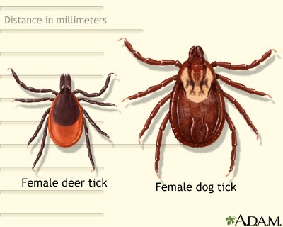 Deer and dog&#160;tick