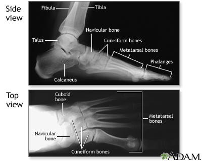 Normal foot X-ray